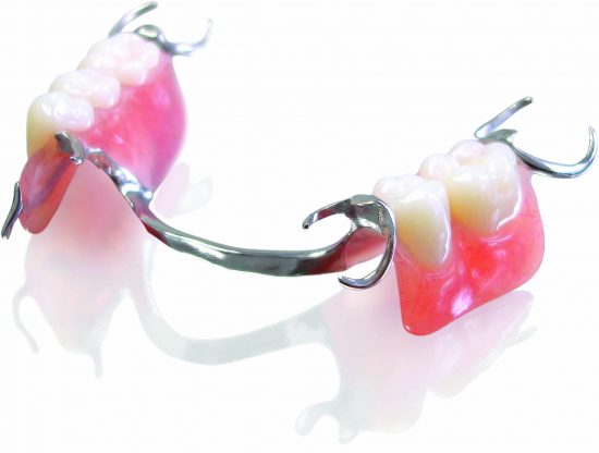 Partial Denture